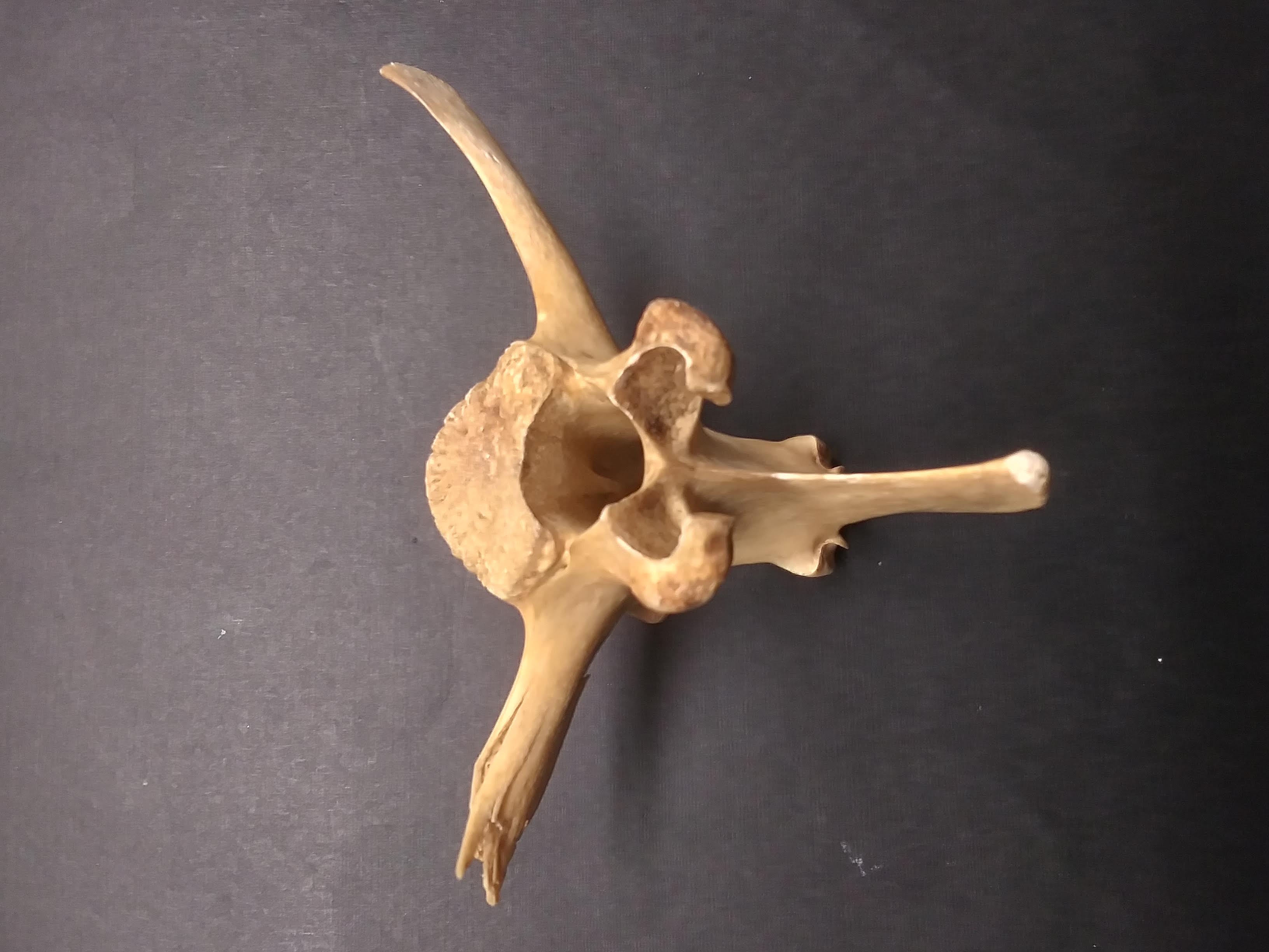 vertebrae