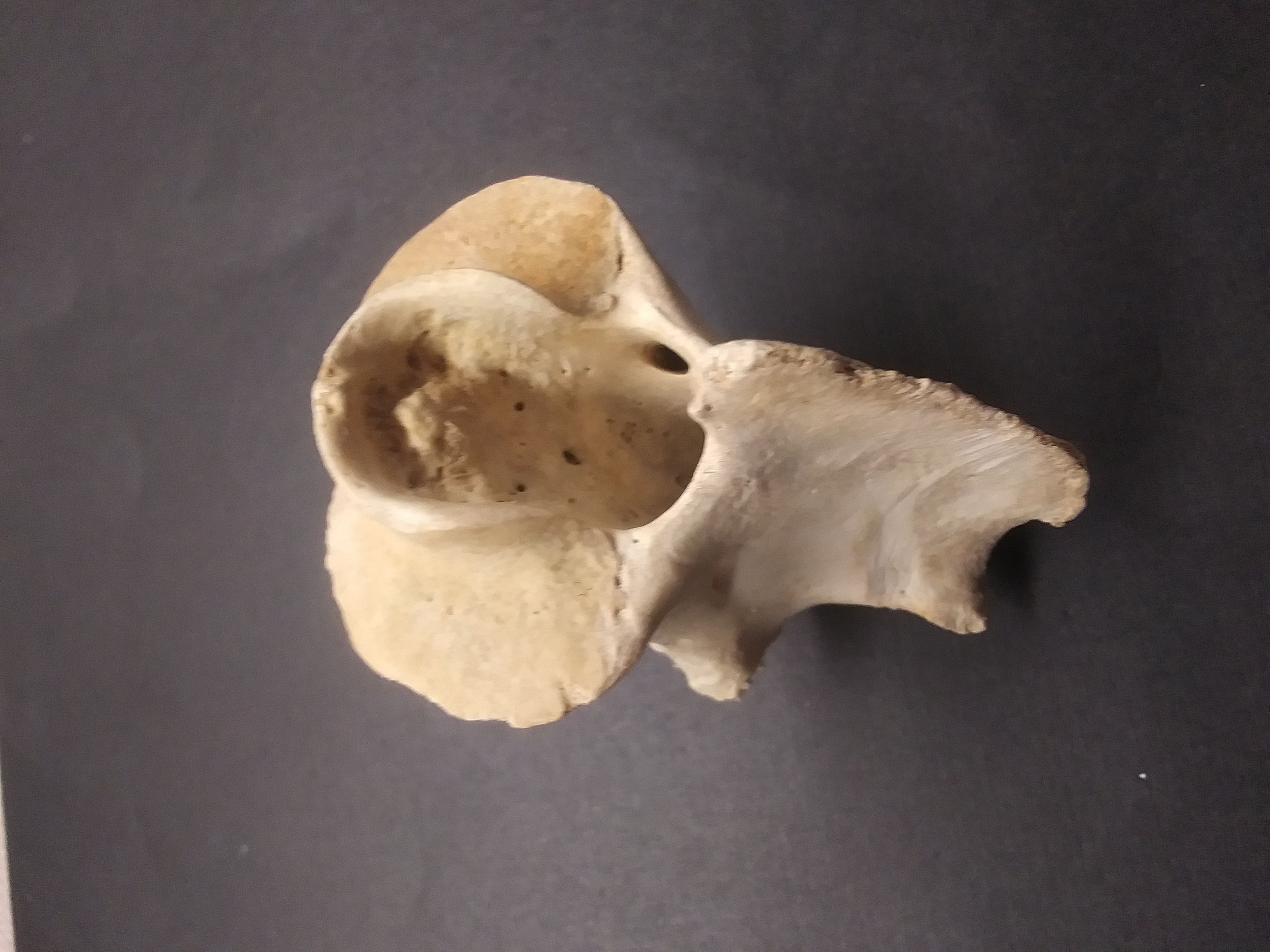 vertebrae