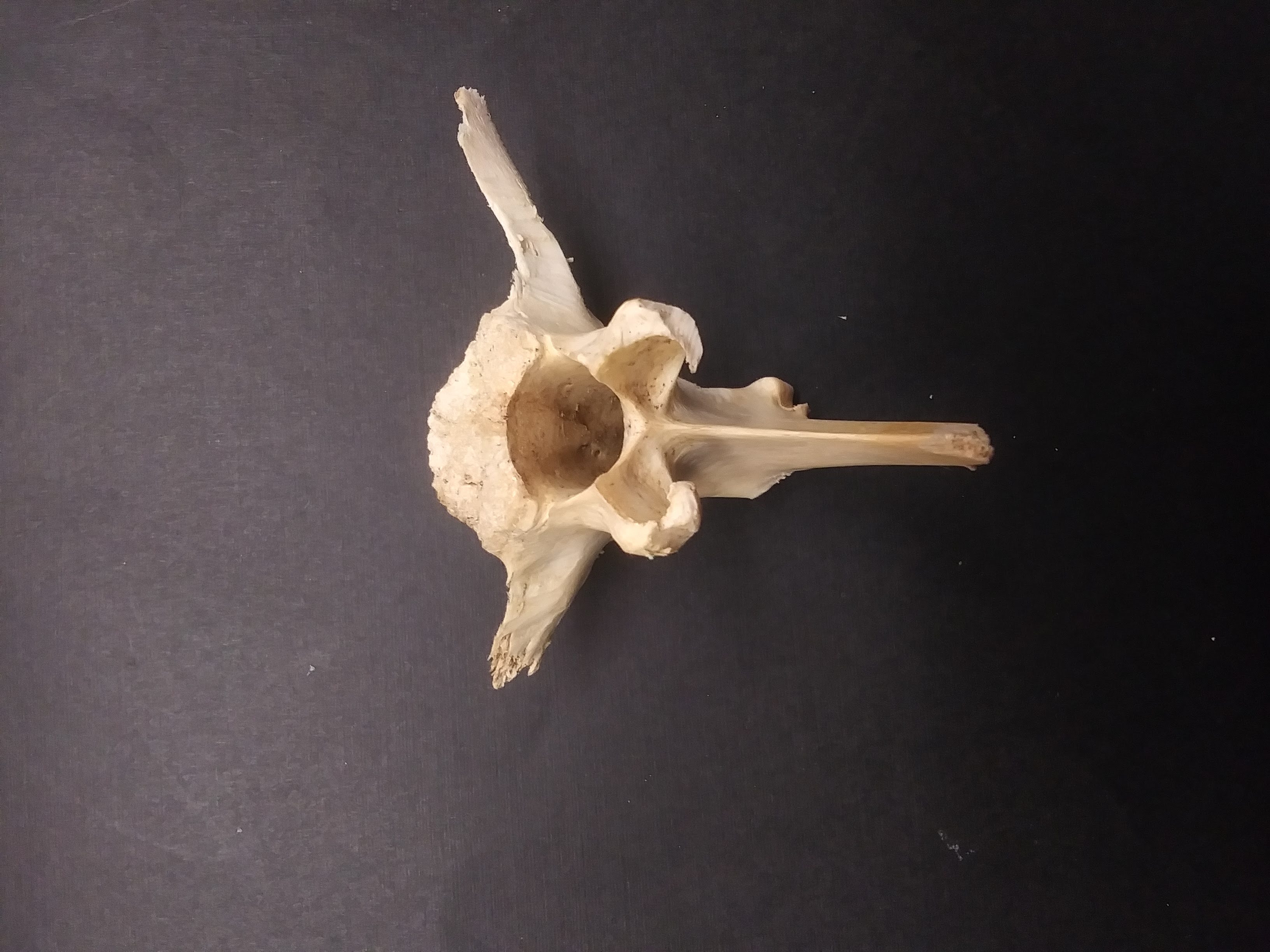 vertebrae